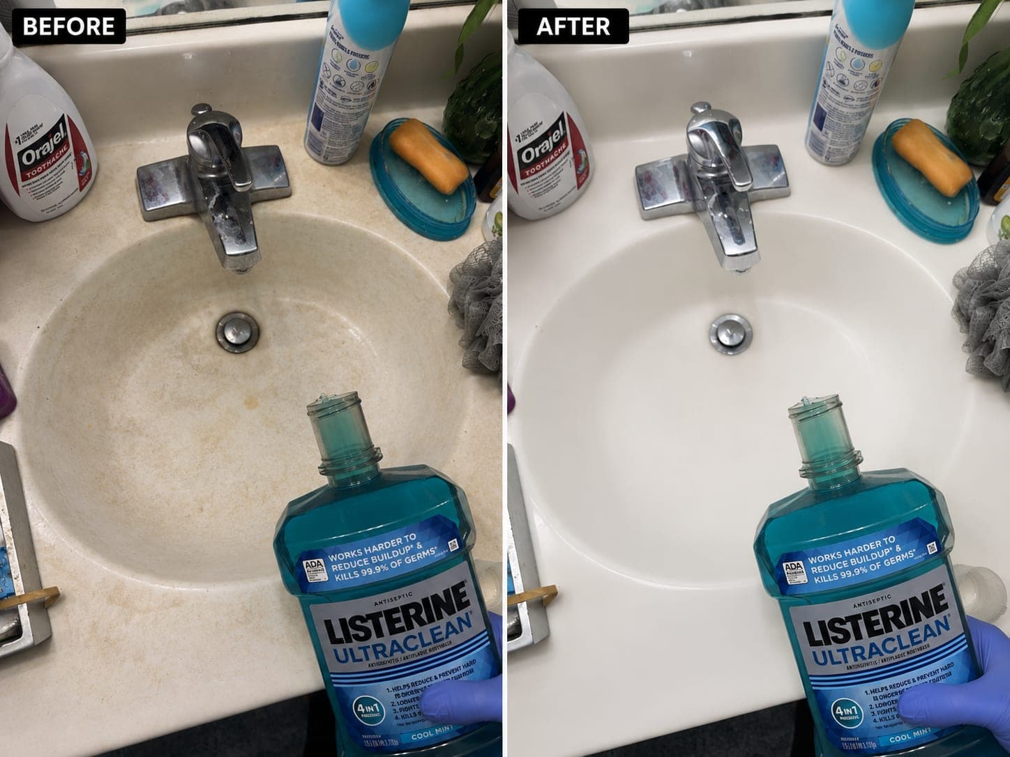 Side-by-side before and after of the same bathroom basin and chrome faucet: the bowl yellowed with rust-brown mineral staining on the left, clean white porcelain on the right.